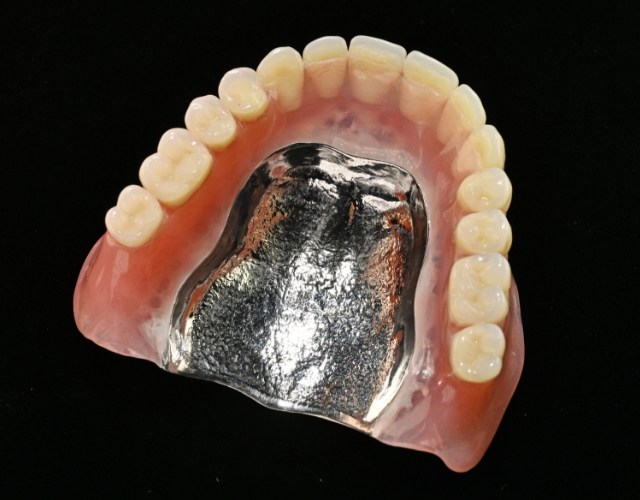 金属床義歯（自費治療）