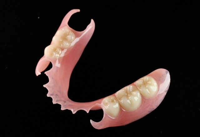 ノンクラスプデンチャー